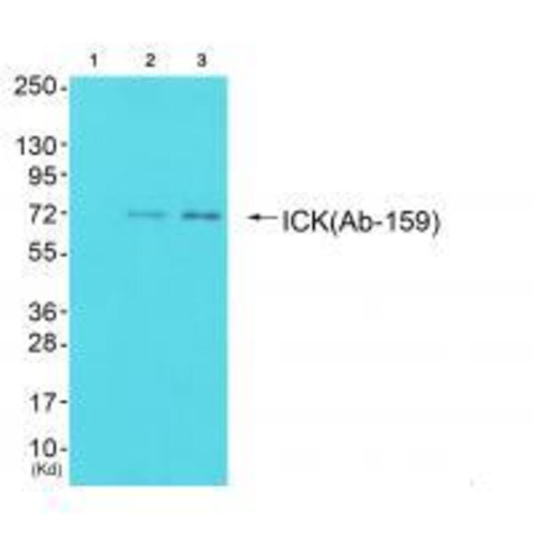 Western blot - ICK (Ab-159) Antibody from Signalway Antibody (33228) - Antibodies.com
