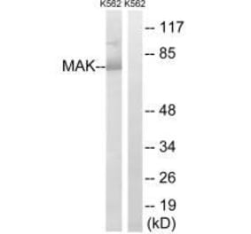 Western blot - MAK (Ab-159) Antibody from Signalway Antibody (33233) - Antibodies.com