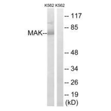 Western blot - MAK (Ab-159) Antibody from Signalway Antibody (33233) - Antibodies.com