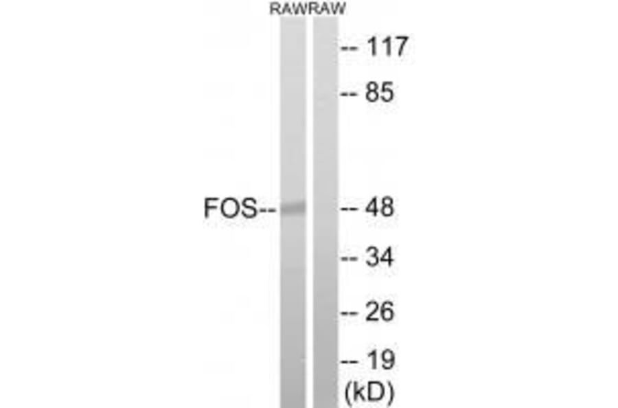 Western blot - FOS (Ab-232) Antibody from Signalway Antibody (33259) - Antibodies.com