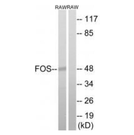 Western blot - FOS (Ab-232) Antibody from Signalway Antibody (33259) - Antibodies.com