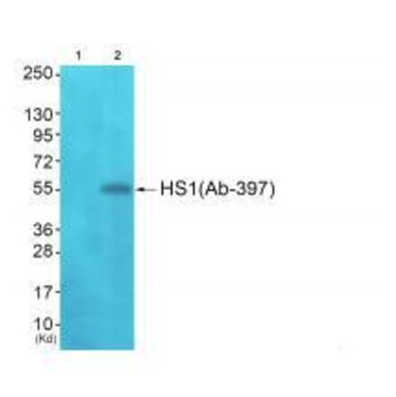 Western blot - HS1 (Ab-397)Antibody from Signalway Antibody (33298) - Antibodies.com