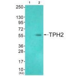 Western blot - TPH2 (Ab-19) Antibody from Signalway Antibody (33305) - Antibodies.com