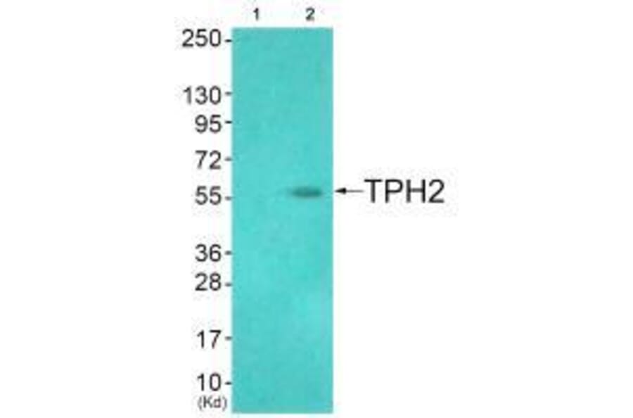 Western blot - TPH2 (Ab-19) Antibody from Signalway Antibody (33305) - Antibodies.com