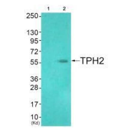 Western blot - TPH2 (Ab-19) Antibody from Signalway Antibody (33305) - Antibodies.com