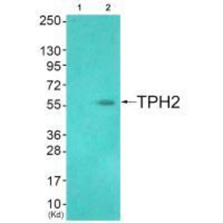 Western blot - TPH2 (Ab-19) Antibody from Signalway Antibody (33305) - Antibodies.com