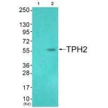 Western blot - TPH2 (Ab-19) Antibody from Signalway Antibody (33305) - Antibodies.com