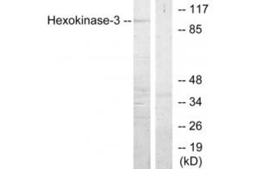 Western blot - Hexokinase-3 Antibody from Signalway Antibody (33809) - Antibodies.com