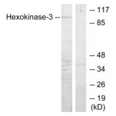 Western blot - Hexokinase-3 Antibody from Signalway Antibody (33809) - Antibodies.com