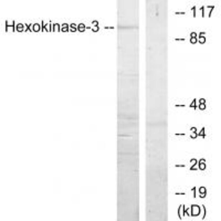 Western blot - Hexokinase-3 Antibody from Signalway Antibody (33809) - Antibodies.com