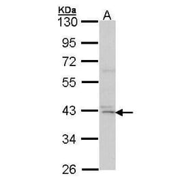 DAP Kinase 2 Antibody from Signalway Antibody (35424) - Antibodies.com