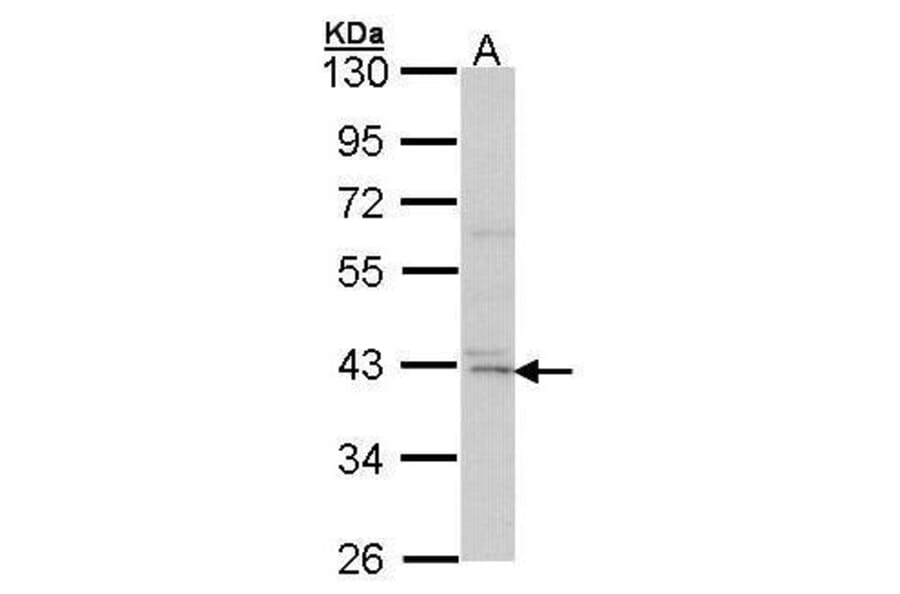 DAP Kinase 2 Antibody from Signalway Antibody (35424) - Antibodies.com