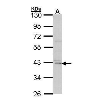 DAP Kinase 2 Antibody from Signalway Antibody (35424) - Antibodies.com