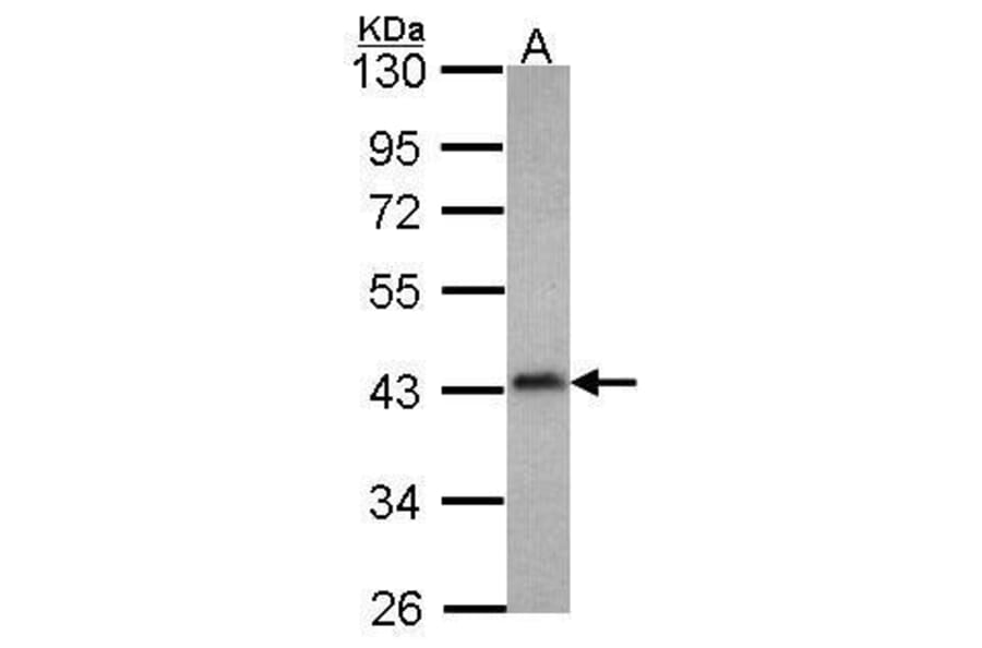 Coronin 2B Antibody from Signalway Antibody (35436) - Antibodies.com