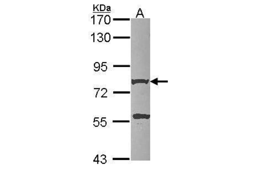 beta Amyloid Antibody from Signalway Antibody (35506) - Antibodies.com