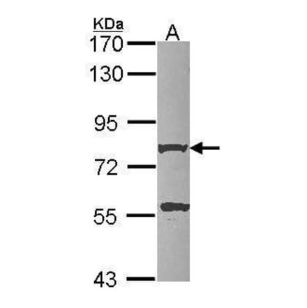 beta Amyloid Antibody from Signalway Antibody (35506) - Antibodies.com