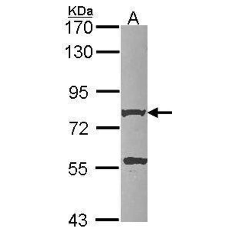 beta Amyloid Antibody from Signalway Antibody (35506) - Antibodies.com