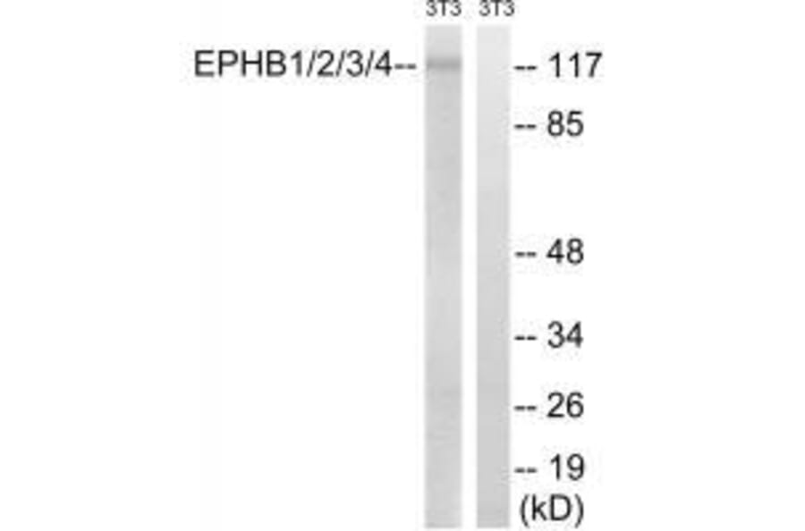 Western blot - EPHB1/2/3/4 (Ab-600/602/614/596) Antibody from Signalway Antibody (33227) - Antibodies.com