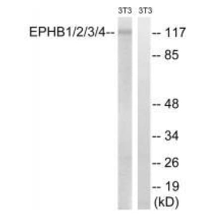 Western blot - EPHB1/2/3/4 (Ab-600/602/614/596) Antibody from Signalway Antibody (33227) - Antibodies.com