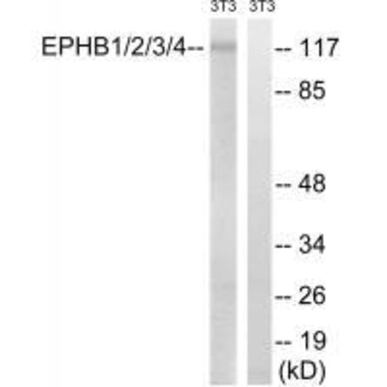 Western blot - EPHB1/2/3/4 (Ab-600/602/614/596) Antibody from Signalway Antibody (33227) - Antibodies.com
