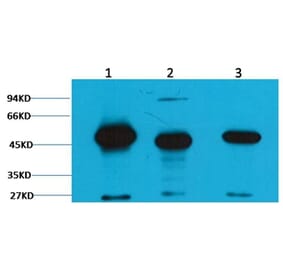 Western blot - Fumarase Mouse Monoclonal Antibody (2B11) from Signalway Antibody (38094) - Antibodies.com