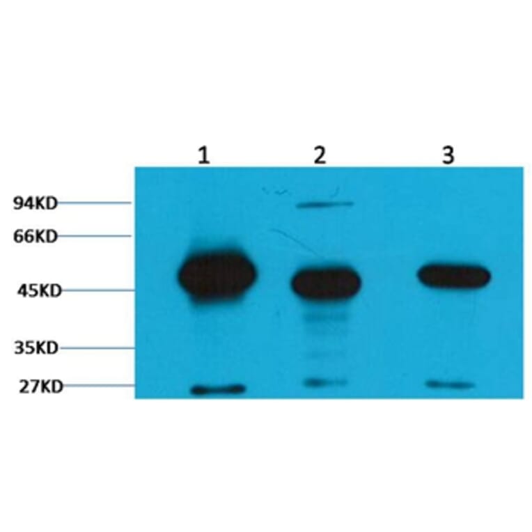 Western blot - Fumarase Mouse Monoclonal Antibody (2B11) from Signalway Antibody (38094) - Antibodies.com