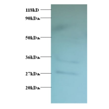 Western blot - GDP-L-fucose synthase Polyclonal Antibody from Signalway Antibody (42179) - Antibodies.com