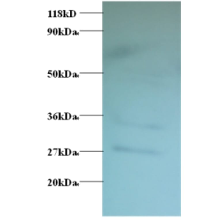 Western blot - GDP-L-fucose synthase Polyclonal Antibody from Signalway Antibody (42179) - Antibodies.com
