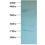 Western blot - GDP-L-fucose synthase Polyclonal Antibody from Signalway Antibody (42179) - Antibodies.com