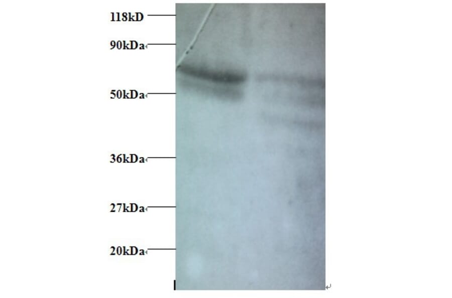 C-C motif chemokine 5 Polyclonal Antibody from Signalway Antibody (42445) - Antibodies.com