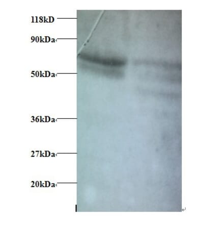 C-C motif chemokine 5 Polyclonal Antibody from Signalway Antibody (42445) - Antibodies.com