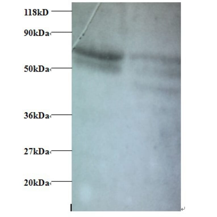 C-C motif chemokine 5 Polyclonal Antibody from Signalway Antibody (42445) - Antibodies.com