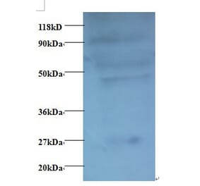 C-C motif chemokine 7 Polyclonal Antibody from Signalway Antibody (42446) - Antibodies.com
