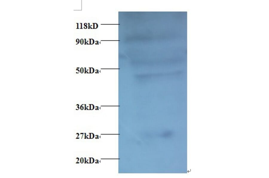C-C motif chemokine 7 Polyclonal Antibody from Signalway Antibody (42446) - Antibodies.com