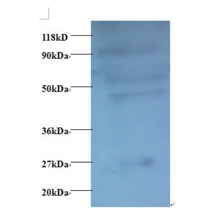 C-C motif chemokine 7 Polyclonal Antibody from Signalway Antibody (42446) - Antibodies.com