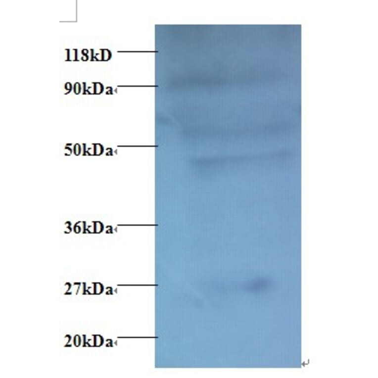C-C motif chemokine 7 Polyclonal Antibody from Signalway Antibody (42446) - Antibodies.com
