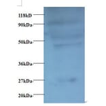 C-C motif chemokine 7 Polyclonal Antibody from Signalway Antibody (42446) - Antibodies.com