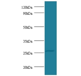 Tumor necrosis factor Polyclonal Antibody from Signalway Antibody (42484) - Antibodies.com