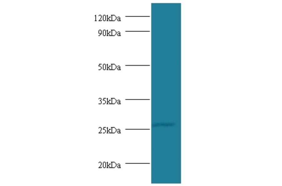 Tumor necrosis factor Polyclonal Antibody from Signalway Antibody (42484) - Antibodies.com