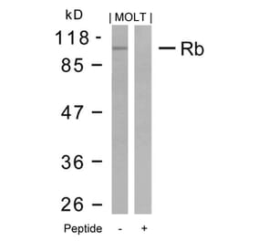 Western blot - Rb (Ab-795) Antibody from Signalway Antibody (21108) - Antibodies.com