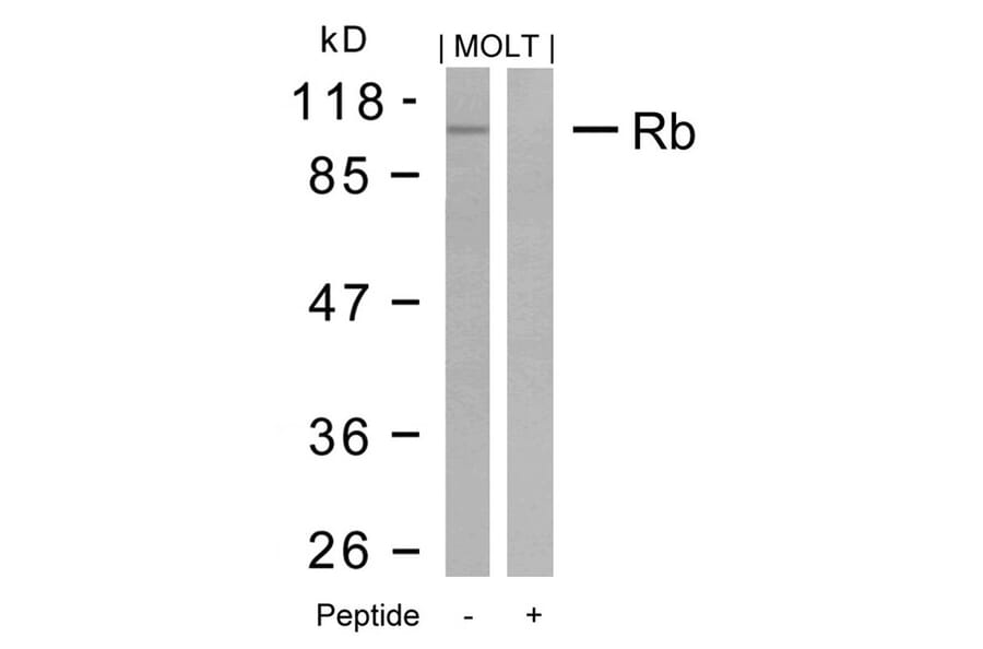 Western blot - Rb (Ab-795) Antibody from Signalway Antibody (21108) - Antibodies.com