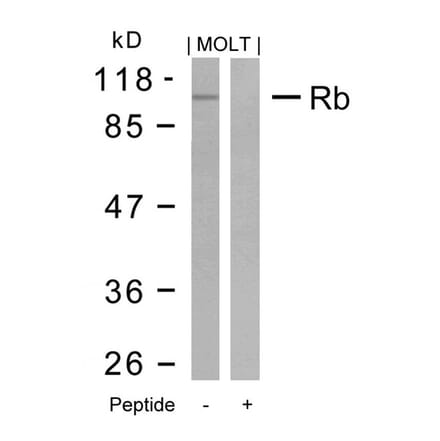 Western blot - Rb (Ab-795) Antibody from Signalway Antibody (21108) - Antibodies.com
