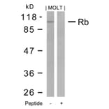 Western blot - Rb (Ab-795) Antibody from Signalway Antibody (21108) - Antibodies.com