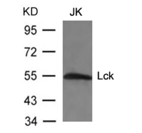 Western blot - Lck (Ab-394) Antibody from Signalway Antibody (21167) - Antibodies.com