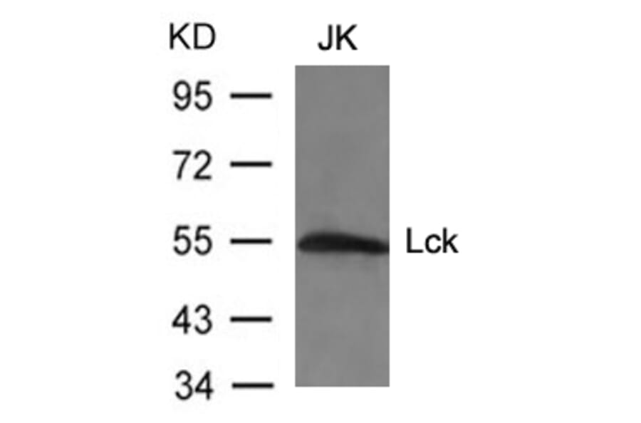 Western blot - Lck (Ab-394) Antibody from Signalway Antibody (21167) - Antibodies.com