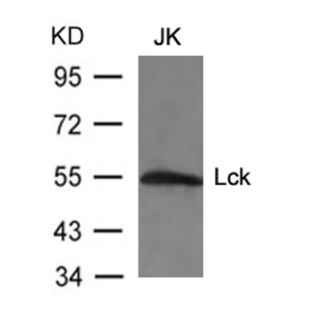 Western blot - Lck (Ab-394) Antibody from Signalway Antibody (21167) - Antibodies.com
