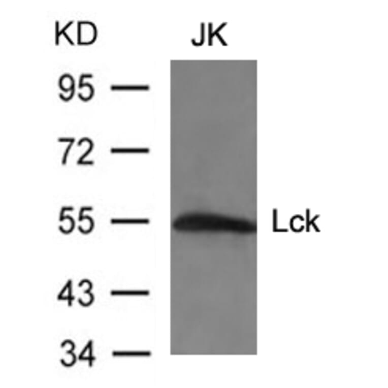 Western blot - Lck (Ab-394) Antibody from Signalway Antibody (21167) - Antibodies.com