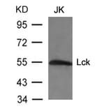 Western blot - Lck (Ab-394) Antibody from Signalway Antibody (21167) - Antibodies.com