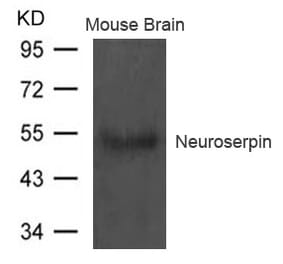 Western blot - Neuroserpin Antibody from Signalway Antibody (21618) - Antibodies.com