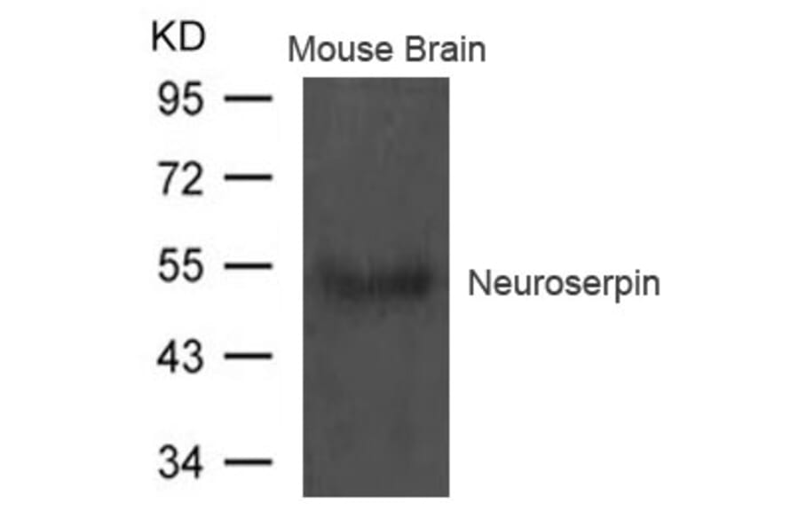 Western blot - Neuroserpin Antibody from Signalway Antibody (21618) - Antibodies.com